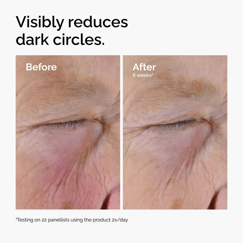 The Ordinary Caffeine Solution 5% + EGCG, 30ml Depuffing Eye Serum for Dark Circles and Tired Eyes